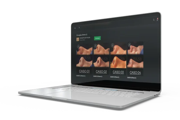 Área de membros Rhinoplasty Films
